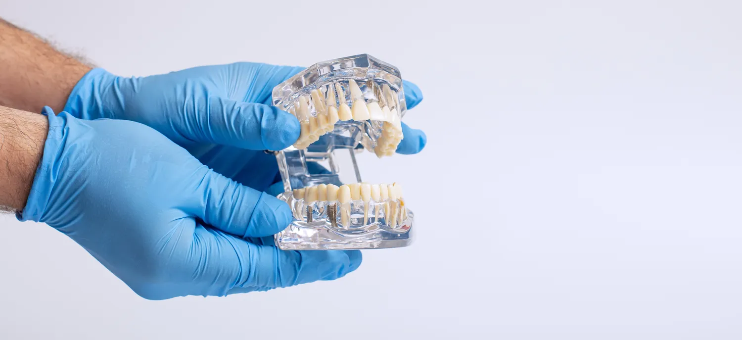 Endodoncja stomatologiczna Szczecin