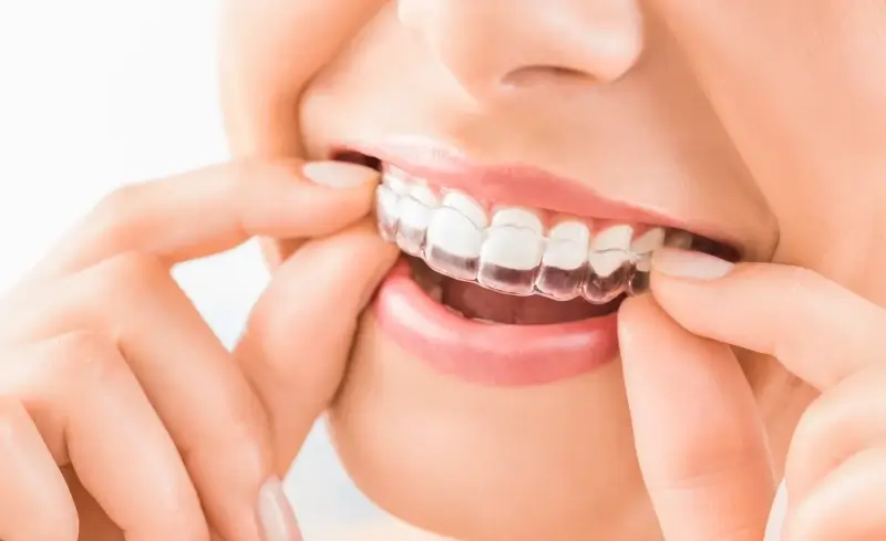 Co trzeba wiedzieć o implantach zębowych?