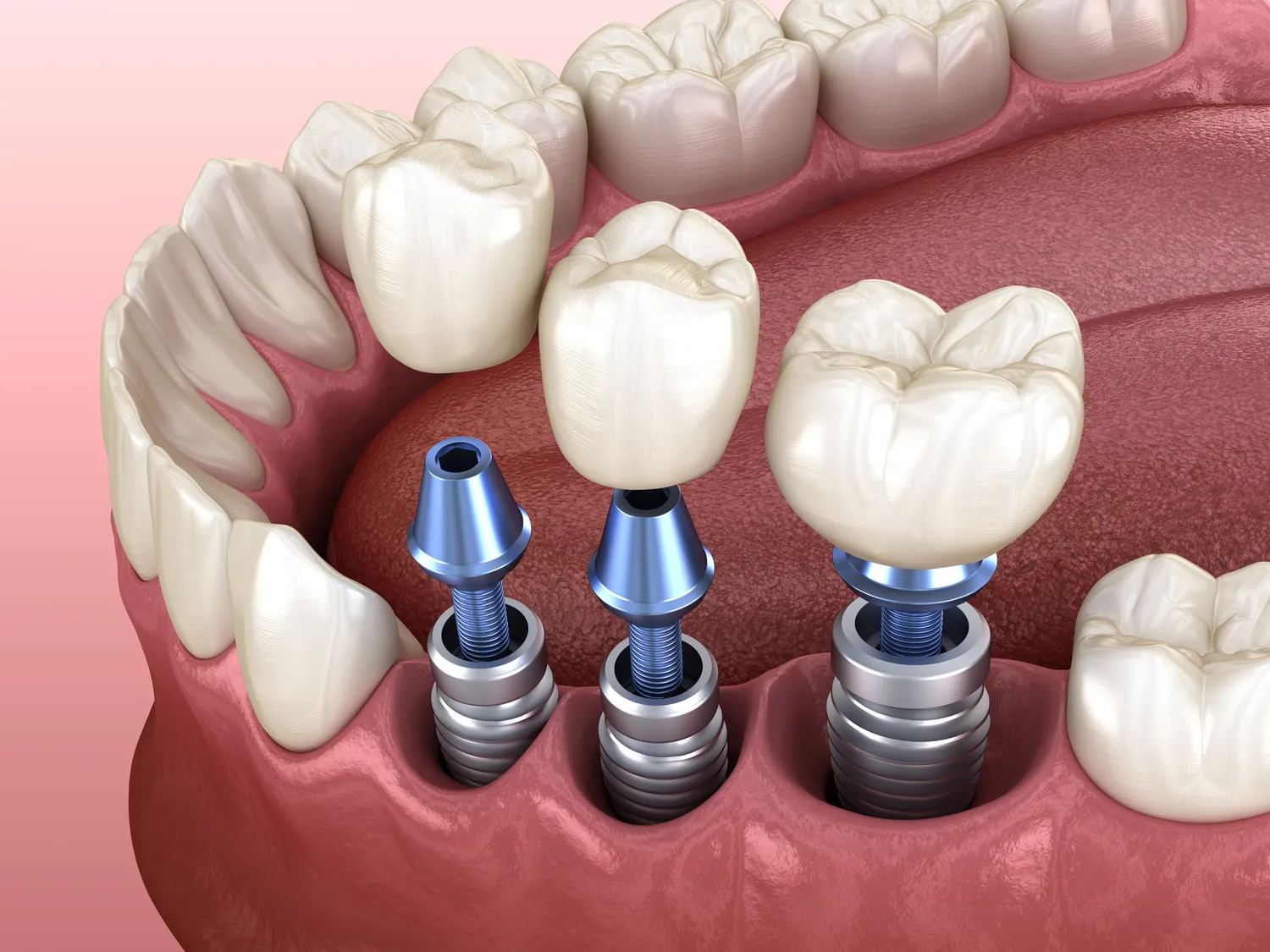 Dlaczego regularne wizyty u dentysty są tak ważne?