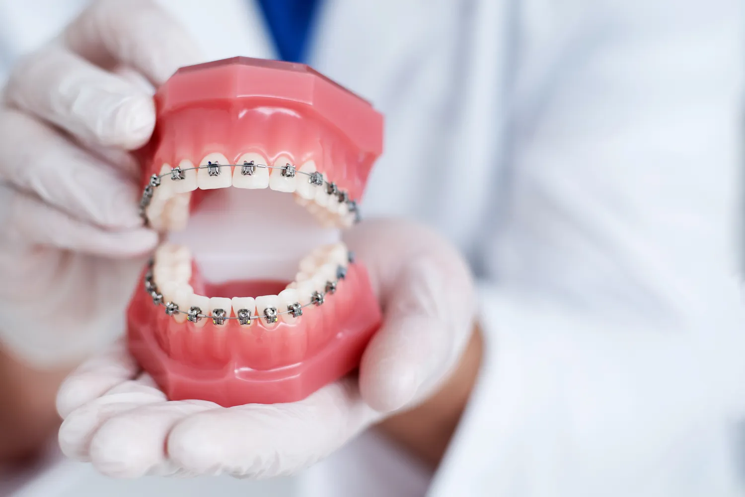 Implanty dentystyczne - czy mogą zastąpić prawdziwe zęby?