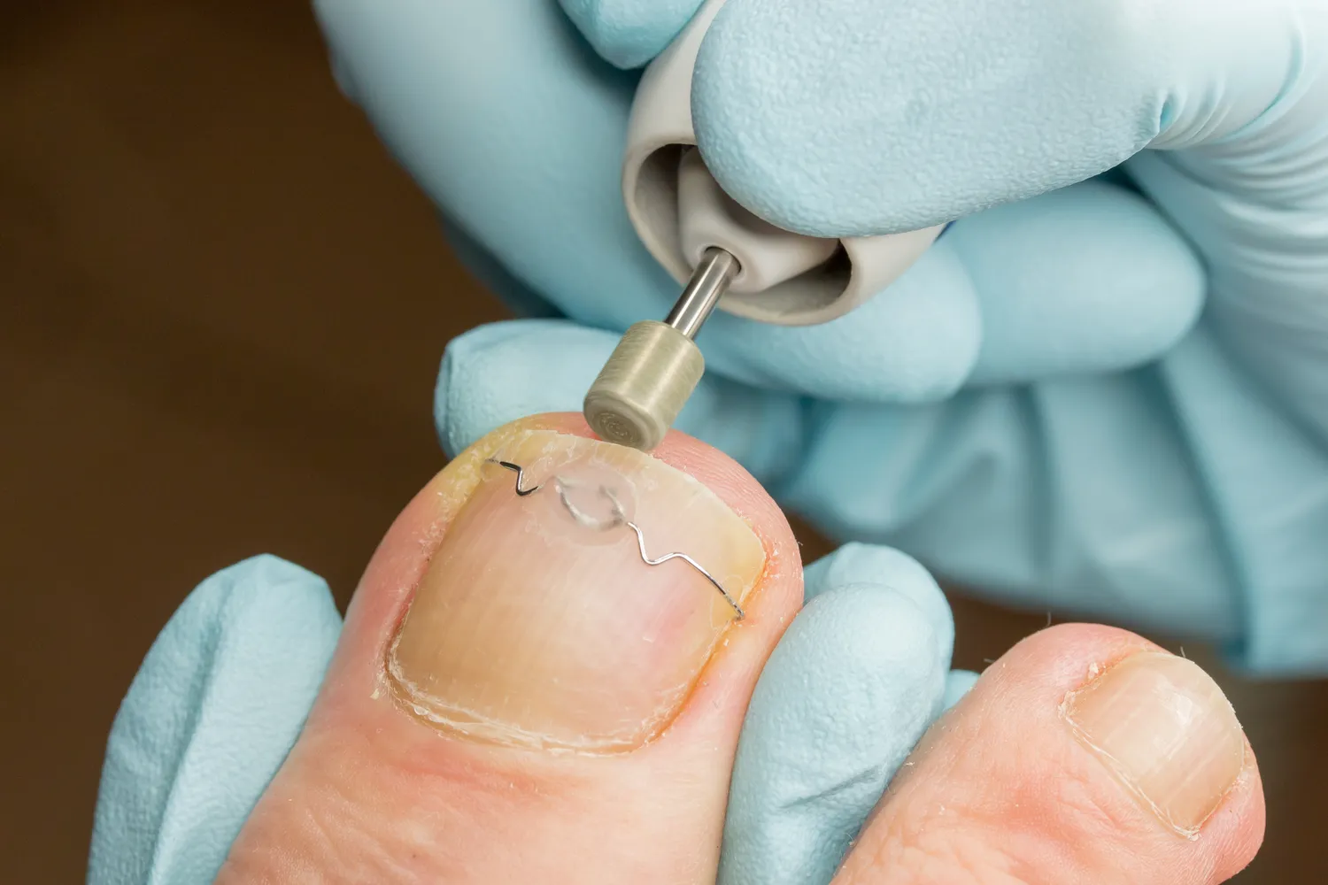 Jak działa gabinet podologiczny?