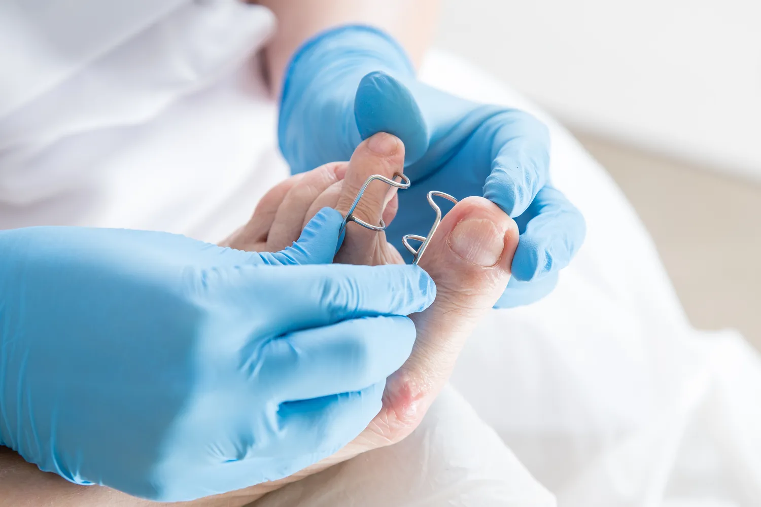 Podologia - co oznacza ten termin?